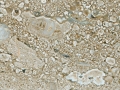 Perlato Olympo